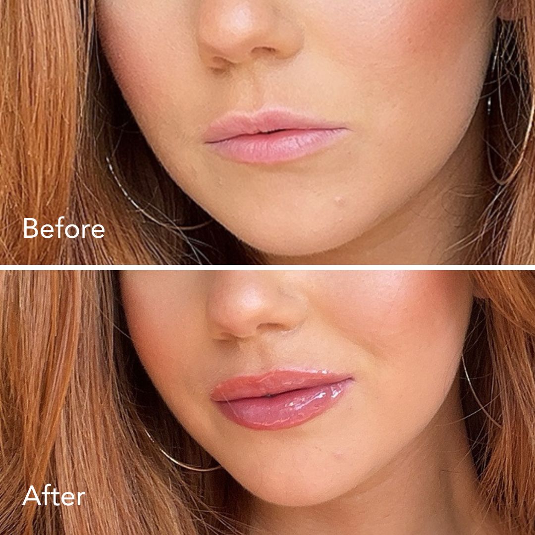 Lip Plumper + Hydrator