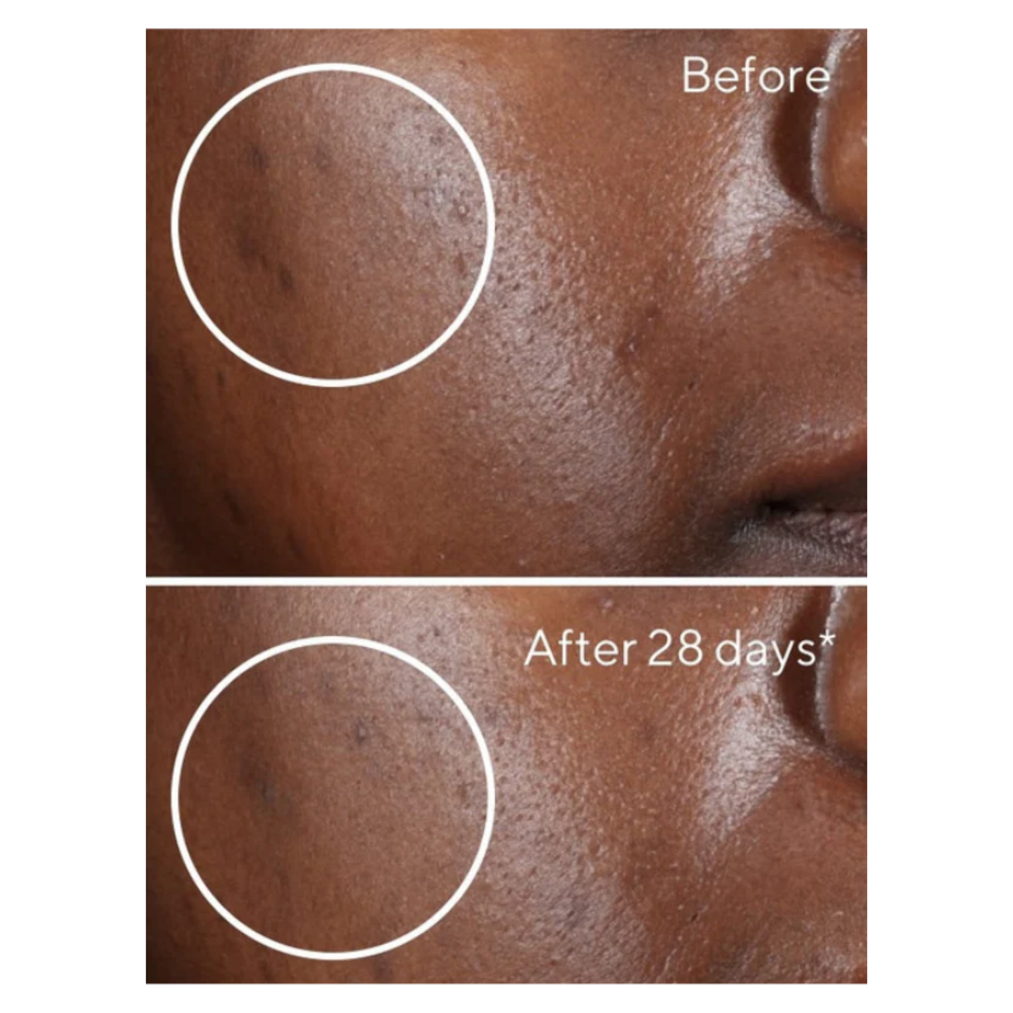 Clinical Hyperpigmentation Treatment Set